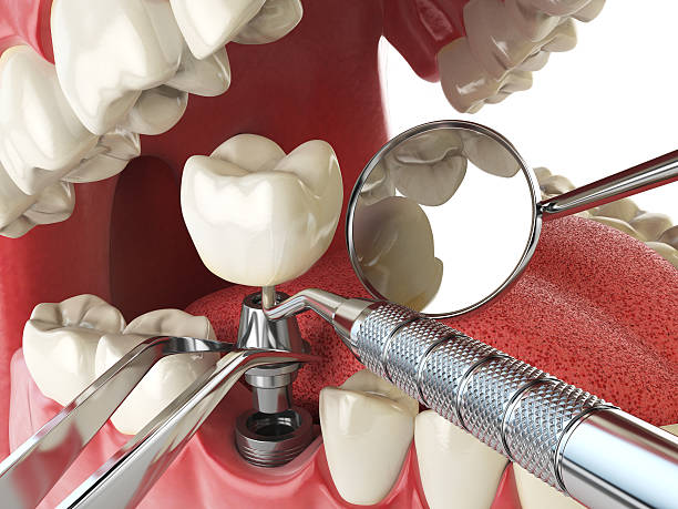 Best Emergency Dental Services for Seniors in Buckeye Lake, OH